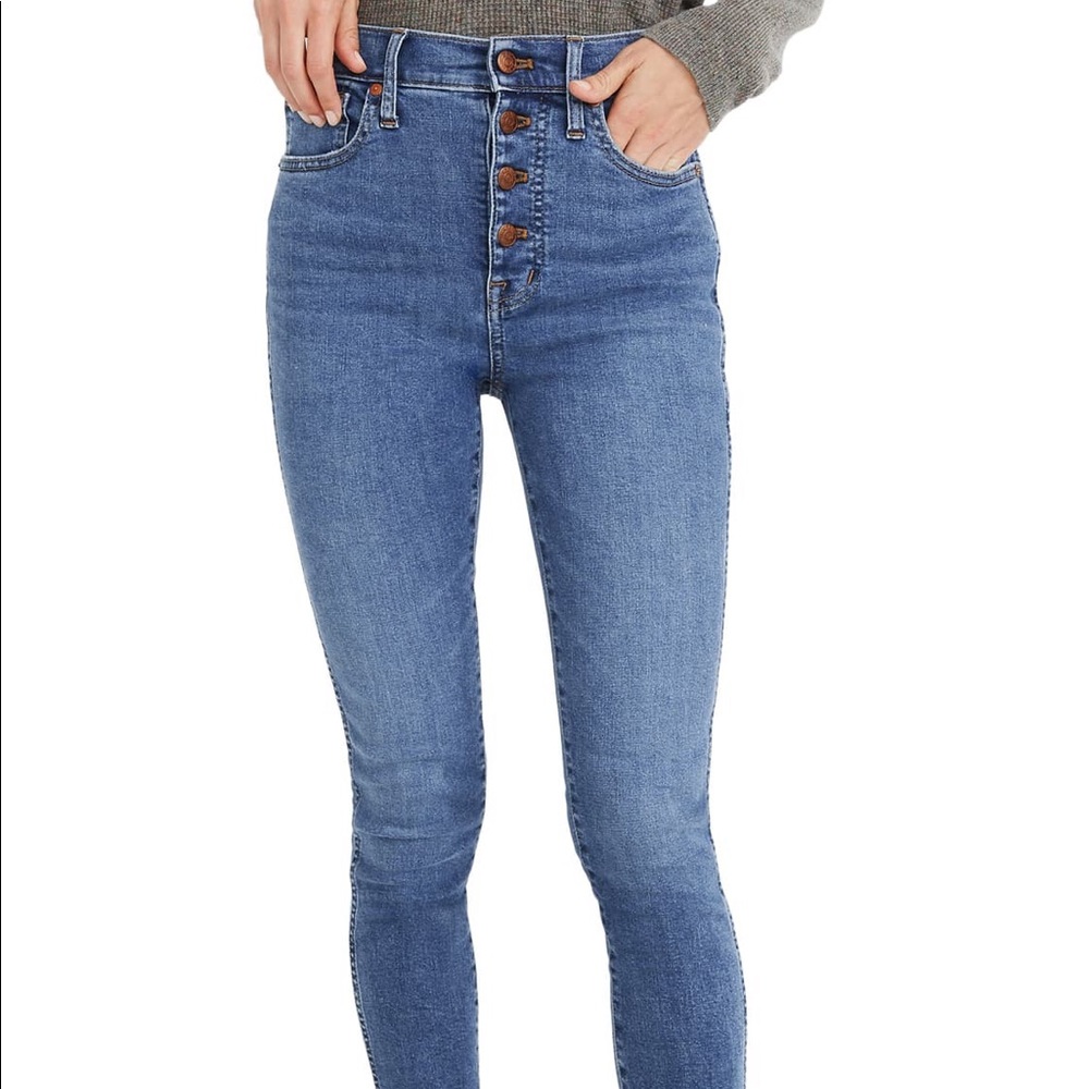 Madewell Button Front Skinny